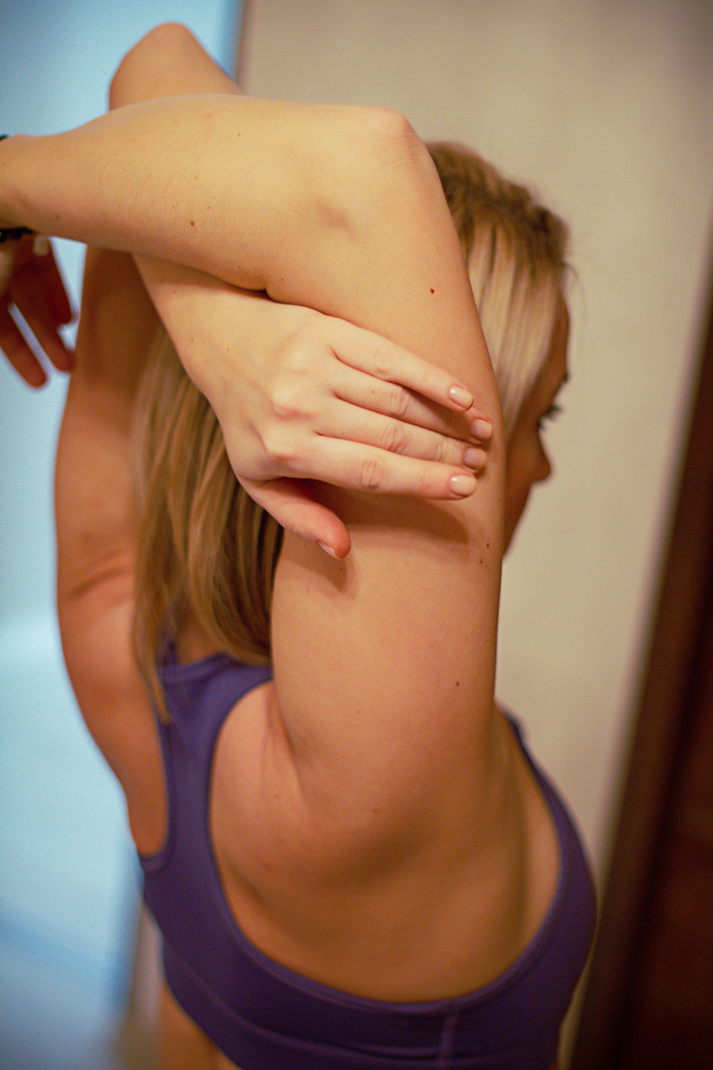 Arm Liposuction