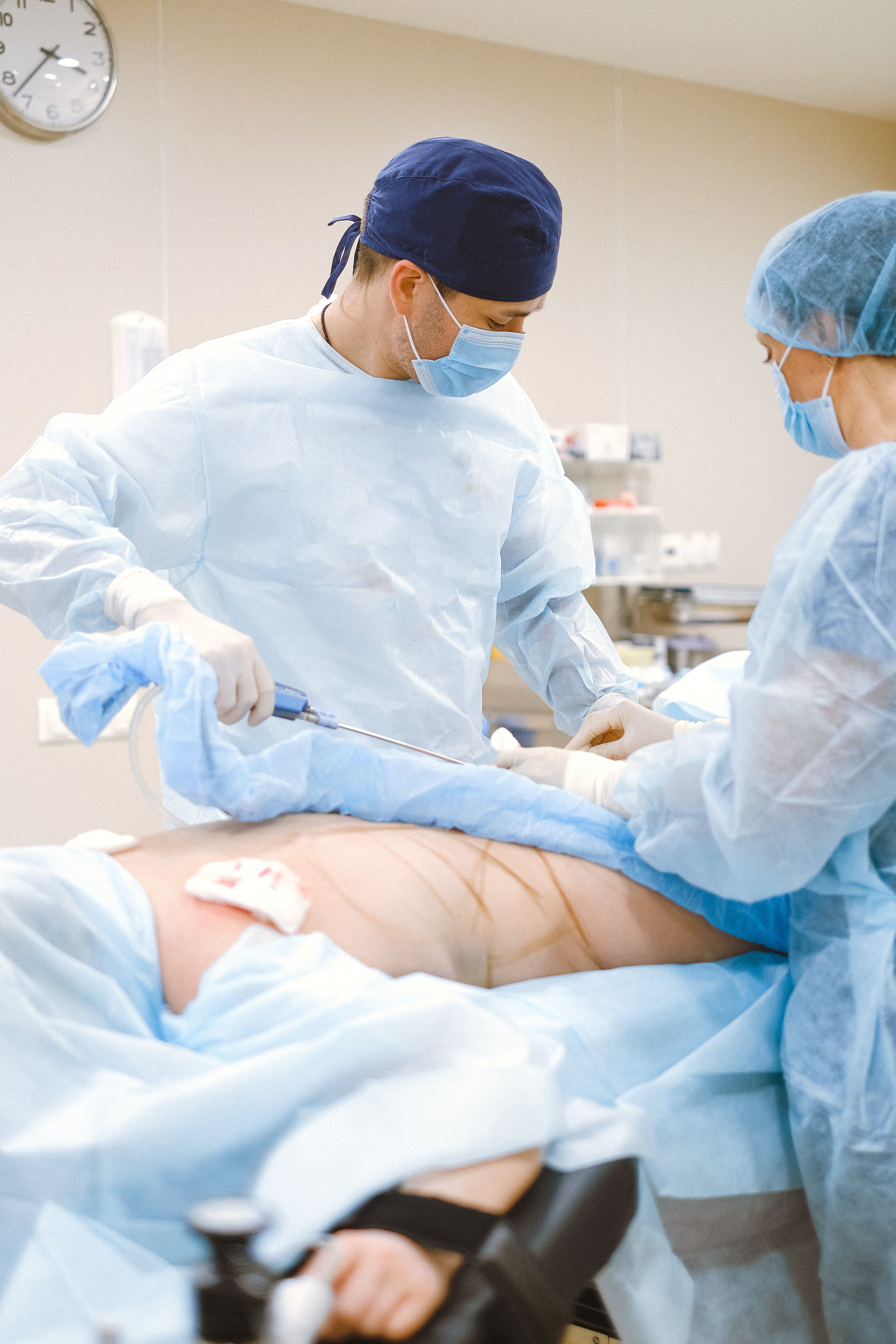 Circumferential Abdominoplasty